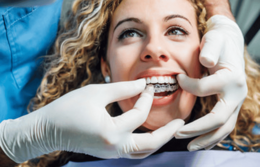 Expert Tips for Keeping Your Invisalign® Aligners Clean