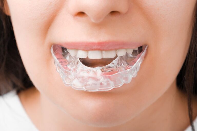 Is Your Retainer Irritating Your Gums Fix It Now